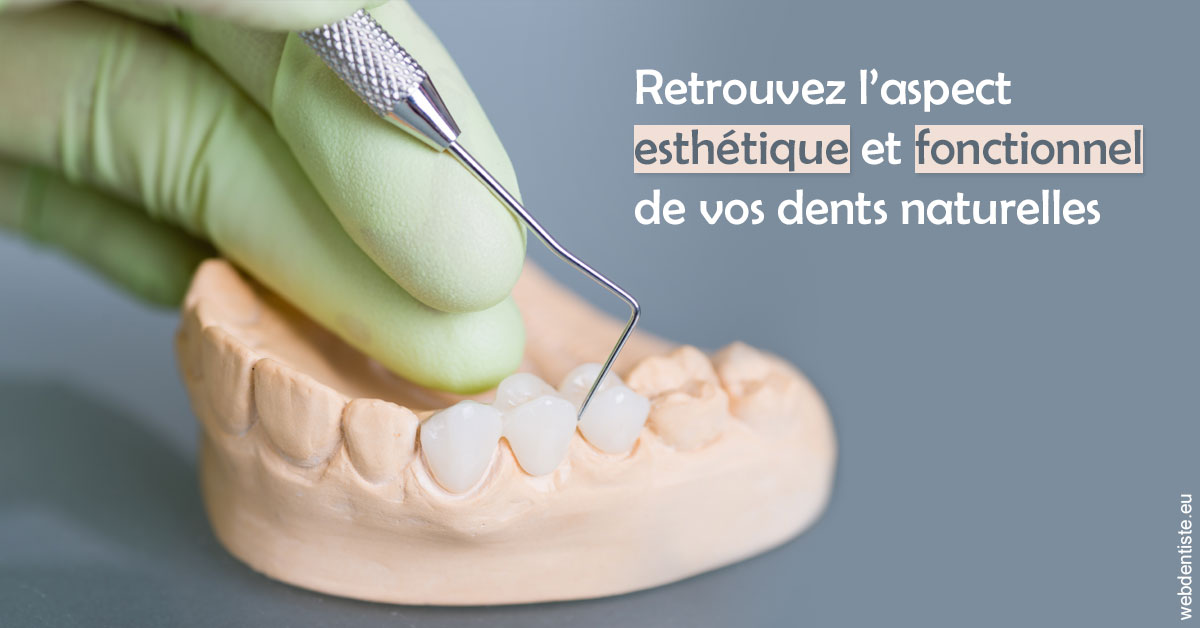 https://dr-acquaviva-cyril.chirurgiens-dentistes.fr/Restaurations dentaires 1