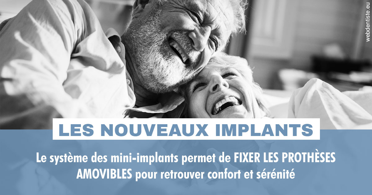 https://dr-acquaviva-cyril.chirurgiens-dentistes.fr/Les nouveaux implants 2