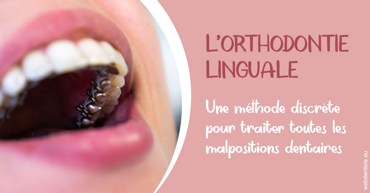 https://dr-acquaviva-cyril.chirurgiens-dentistes.fr/L'orthodontie linguale 2