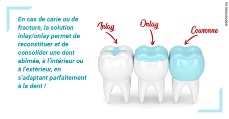 https://dr-acquaviva-cyril.chirurgiens-dentistes.fr/L'INLAY ou l'ONLAY