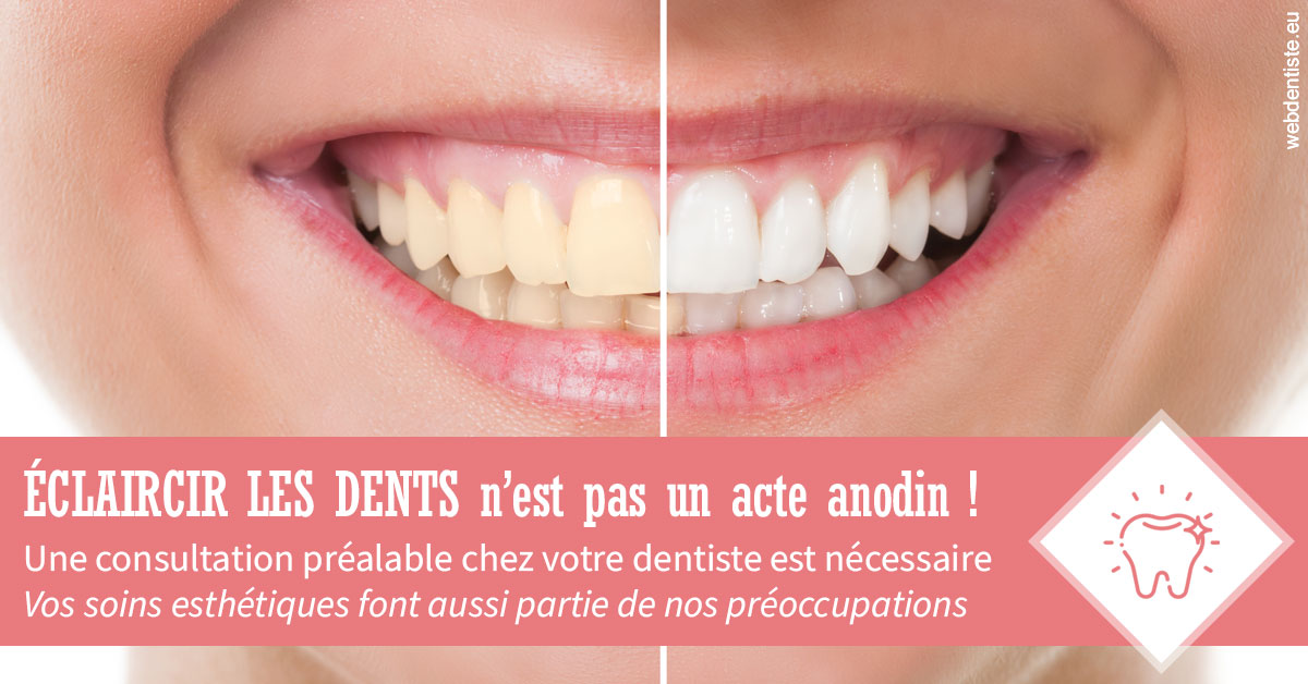 https://dr-acquaviva-cyril.chirurgiens-dentistes.fr/Eclaircir les dents 1