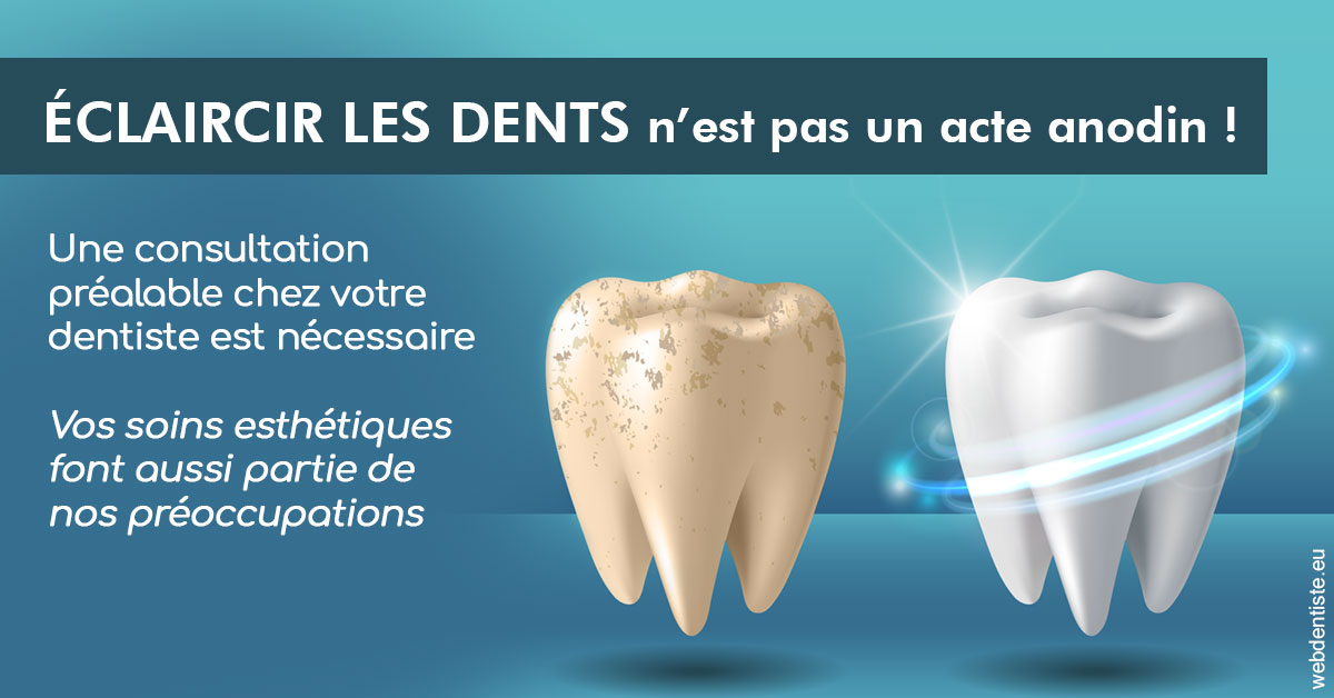 https://dr-acquaviva-cyril.chirurgiens-dentistes.fr/Eclaircir les dents 2