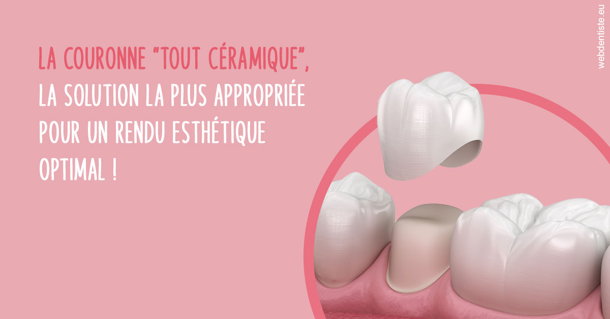https://dr-acquaviva-cyril.chirurgiens-dentistes.fr/La couronne "tout céramique"
