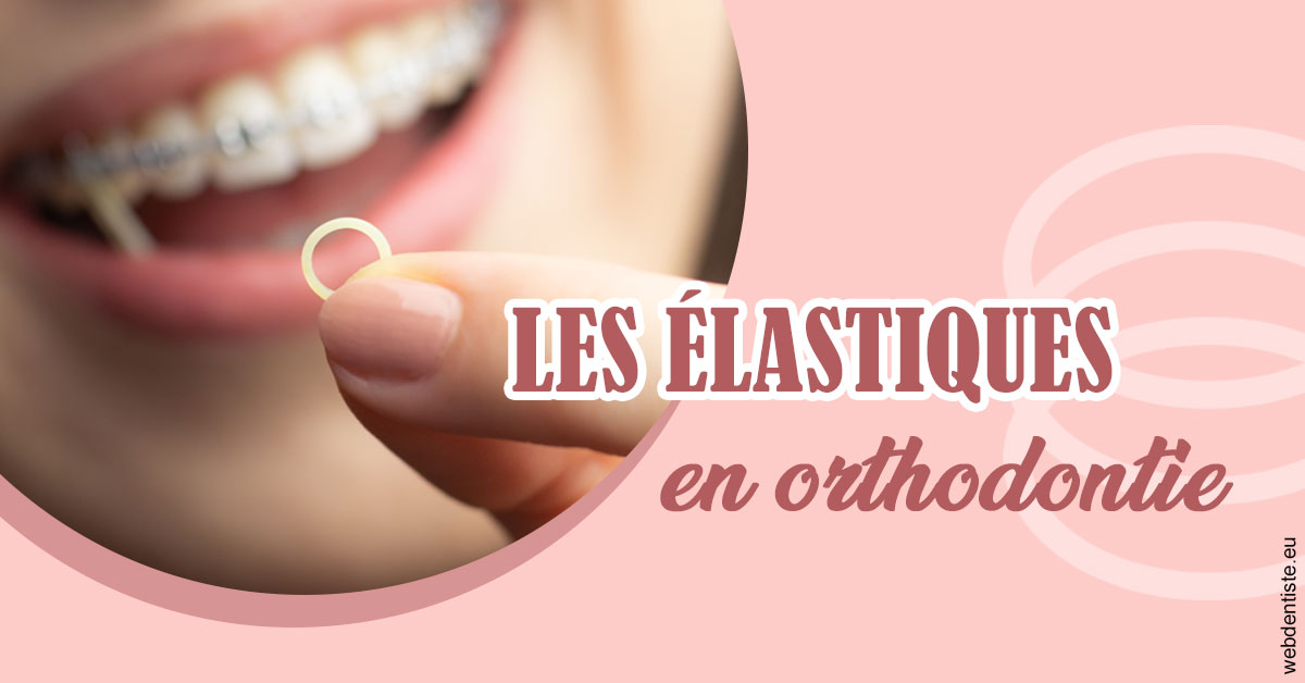 https://dr-acquaviva-cyril.chirurgiens-dentistes.fr/Elastiques orthodontie 1