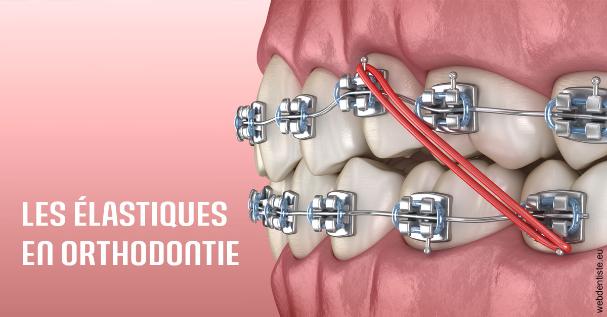 https://dr-acquaviva-cyril.chirurgiens-dentistes.fr/Elastiques orthodontie 2