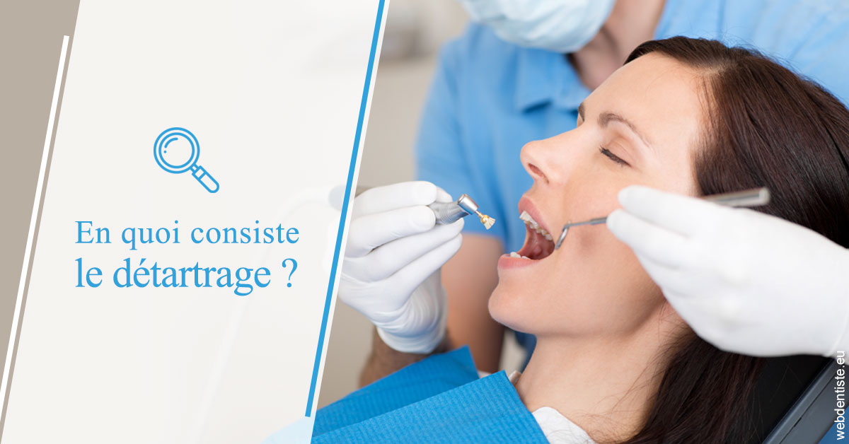 https://dr-acquaviva-cyril.chirurgiens-dentistes.fr/En quoi consiste le détartrage