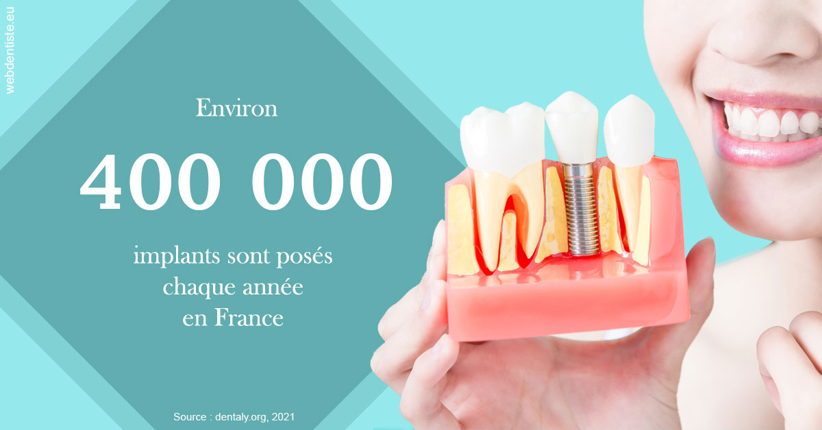 https://dr-acquaviva-cyril.chirurgiens-dentistes.fr/Pose d'implants en France 2
